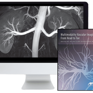 Multimodality Vascular Imaging: From Head to Toe 2020 (CME VIDEOS)