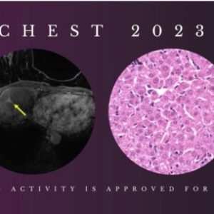 Chest Imaging 2023 CME science course