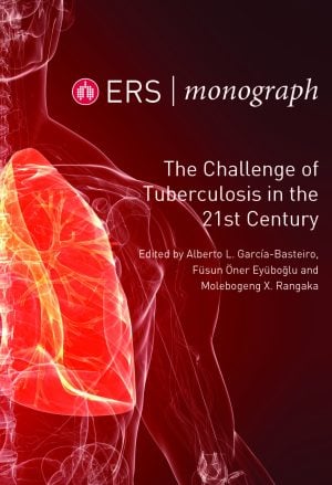 The Challenge of Tuberculosis in the 21st Century, 3rd Edition (EPUB)