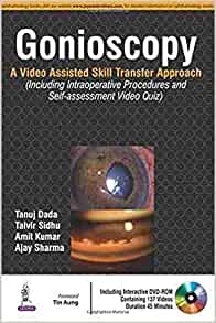 Gonioscopy:A Video Assisted Skill Transfer Approach (Videos Only)