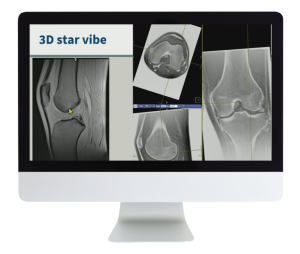 American Roentgen Ray Society 3D MR Imaging of Joints with Arthroscopy Correlations 2023 American Roentgen Ray Society 3D MR Imaging of Joints with Arthroscopy Correlations 2023