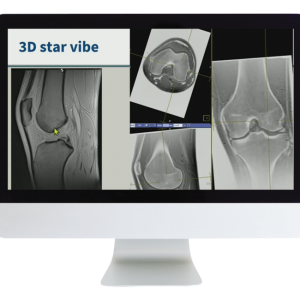 American Roentgen Ray Society 3D MR Imaging of Joints with Arthroscopy Correlations 2023 American Roentgen Ray Society 3D MR Imaging of Joints with Arthroscopy Correlations 2023