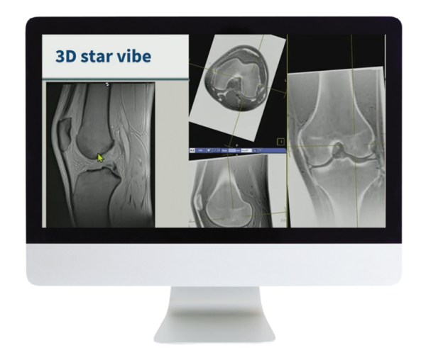 American Roentgen Ray Society 3D MR Imaging of Joints with Arthroscopy Correlations 2023 American Roentgen Ray Society 3D MR Imaging of Joints with Arthroscopy Correlations 2023