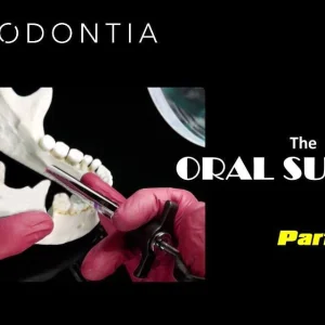 Exodontia Comprehensive Oral Surgery – Jason Hoium Module 1-13