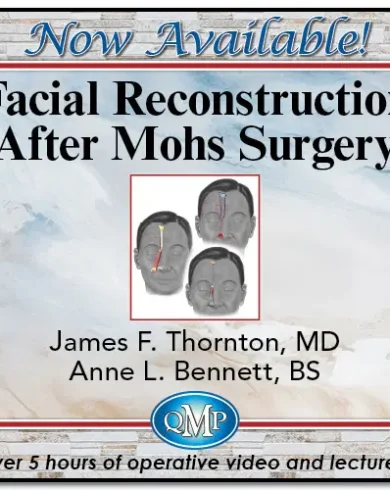 Facial Reconstruction After Mohs Surgery 2024