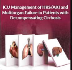 ICU Management of HRS/AKI and Multiorgan Failure in Patients 2024