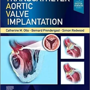 Transcatheter Aortic Valve Implantation (Original PDF from Publisher)