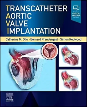 Transcatheter Aortic Valve Implantation (Original PDF from Publisher)