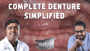 Complete Dentures Simplified