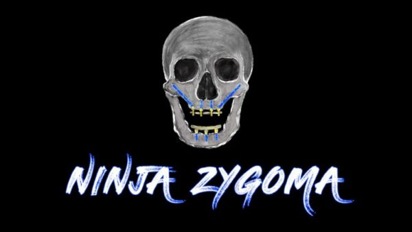 Ninja Zygoma – Implant Ninja