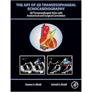 The Art Of 2D Transesophageal Echocardiography (PDF Book+ Videos )