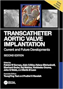 Transcatheter Aortic Valve Implantation: Current and Future Developments, 2nd edition (Original PDF from Publisher)