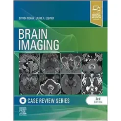 Brain Imaging: Case Review Series, 3rd Edition (Original PDF From Publisher)