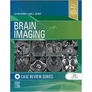 Brain Imaging: Case Review Series, 3rd Edition (Original PDF From Publisher)