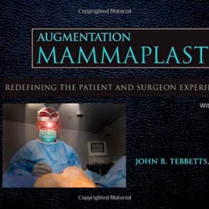 Augmentation Mammaplasty with DVD: Redefining the Patient and Surgeon Experience 1st Edition