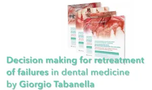 Decision Making for Retreatment of Failures in Dental Medicine