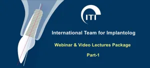 ITI International Team for Implantology Webinar & Video Lectures Package Part-1 (99 Videos)