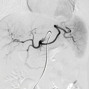 NYU Langone Vascular and Interventional Radiology Review and Update 2023