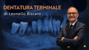 Osteocom dentatura terminale by Leonello Biscaro – italian