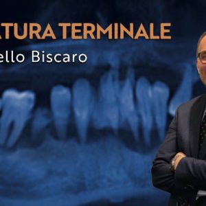 Osteocom dentatura terminale by Leonello Biscaro – italian