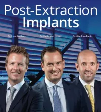 Post-Extraction Implants (Video course)