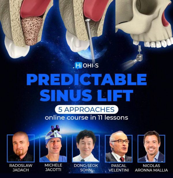 Predictable Sinus Lift Course