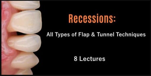 Recessions: All Types of Flap & Tunnel Techniques