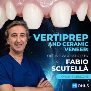 Vertical Preparation and Ceramic Veneers (VertiPrep)