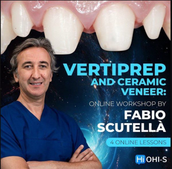 Vertical Preparation and Ceramic Veneers (VertiPrep)