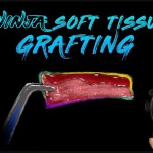 Ninja Soft Tissue Grafting