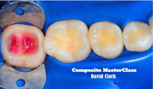 Composite Masterclass – David Clark