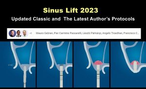 OHI-S Sinus Lift 2023: Updated Classic and the Latest Author’s Protocols