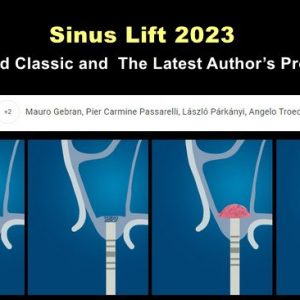 OHI-S Sinus Lift 2023: Updated Classic and the Latest Author’s Protocols