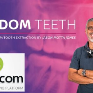 Osteocom Wisdom Tooth Extraction Jason Motta Jones