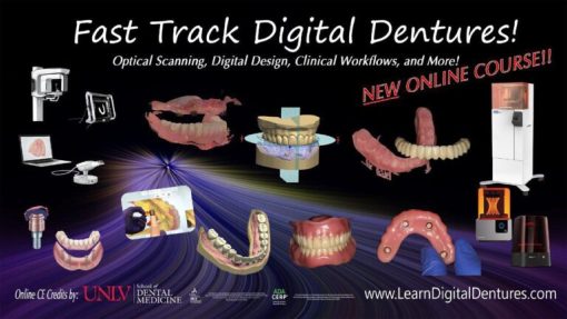 Step-by-Step Digital Dentures For the Dentist and Technician – Scanners, Software, Lab Techniques, and More! (CME VIDEOS)