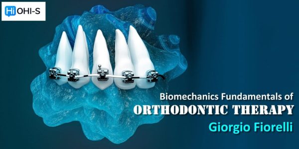 OHI-S Biomechanics Fundamentals of Orthodontic Therapy – Giorgio Fiorelli