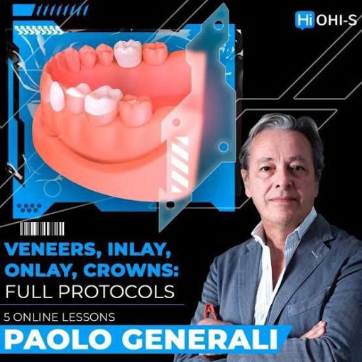 OHI-S Veneers, inlay, onlay, crowns: full protocols (Videos)