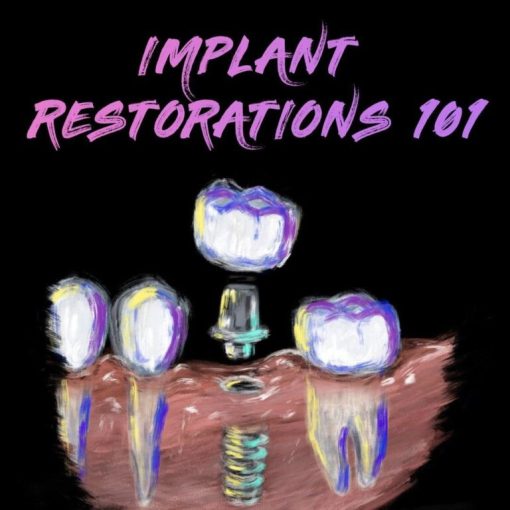 Implant Restorations 101 – Implant Ninja