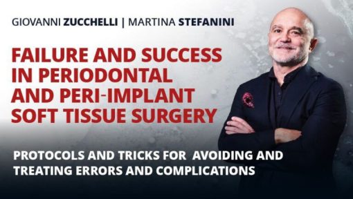 Osteocom – Failure and Success in Periodontal and Peri-Implant Soft Tissue Surgery – Giovanni Zucchelli and Martina Stefanini