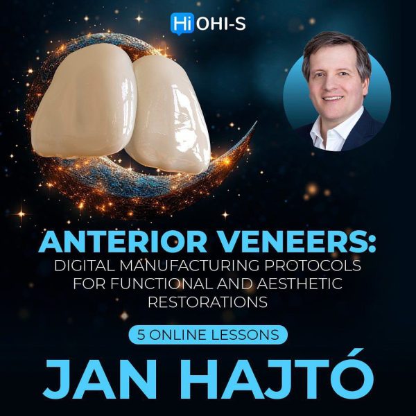 OHI-S Anterior veneers: Digital manufacturing protocols for functional and aesthetic restorations