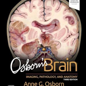 Osborn’s Brain: Imaging,Pathology and Anatomy 3e 2024 Original PDF