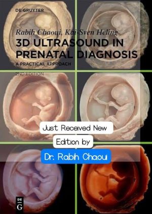 3D Ultrasound in prenatal diagnosis by Rabih Chaoui 2nd edition original PDF 2024