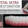 AOX Crystal Ultra Hybrid Restoration: All Clinical & Lab Steps Start to Finish