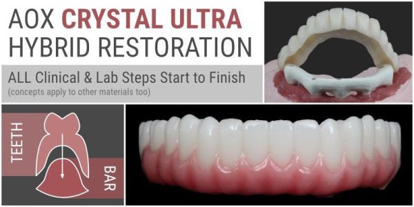 AOX Crystal Ultra Hybrid Restoration: All Clinical & Lab Steps Start to Finish