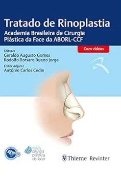 Tratado de Rinoplastia: Academia Brasileira de Cirurgia Plástica da Face da ABORL-CCF (Portuguese Edition) (AZW3 + EPUB + Converted PDF)