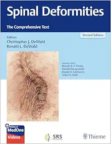 Spinal Deformities: The Comprehensive Text, 2nd edition (Original PDF from Publisher+Videos)