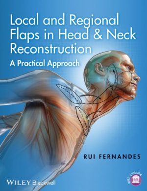 Local and Regional Flaps in Head & Neck Reconstruction: A Practical Approach (Original PDF from Publisher)