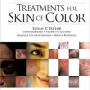 Treatments for Skin of Color