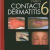 Fisher’s Contact Dermatitis, 6th Edition (Original PDF from Publisher)