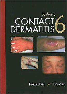 Fisher’s Contact Dermatitis, 6th Edition (Original PDF from Publisher)